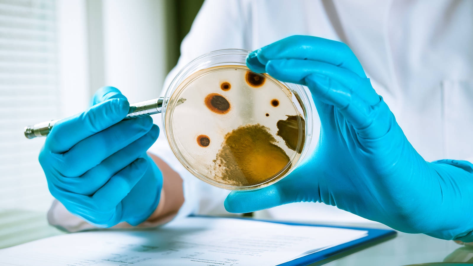 Oil, moisture and bacteria petrischale